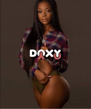 Фотография номер 4 - Moyo, 20 лет